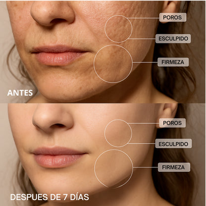 Masajeador rejuvenecimiento y lifting facial - ELYSSHE™ PRO