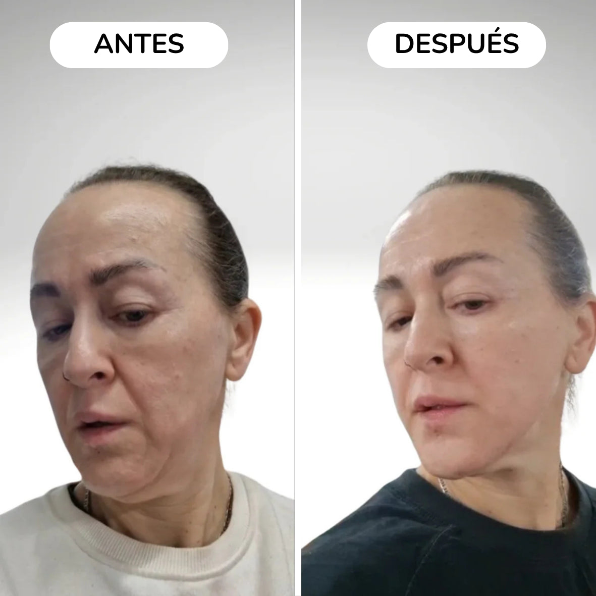 Masajeador rejuvenecimiento y lifting facial - ELYSSHE™ PRO